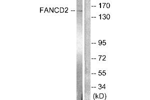 Western blot analysis of extracts from HT-29 cells, treated with Calyculin A (50ng/ml, 30mins), using FANCD2 (Ab-222) antibody (#B0427). (FANCD2 antibody  (Ser222))