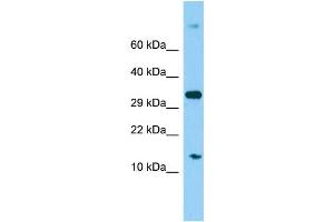 Host: Rabbit Target Name: MRPS16 Sample Type: 293T Whole Cell lysates Antibody Dilution: 1. (MRPS16 antibody  (C-Term))