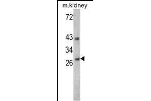 Western blot analysis of ENDOG Antibody (C-term) (Cat. (Endonuclease G antibody  (C-Term))