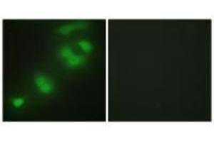 Immunofluorescence analysis of HepG2 cells, using CREBZF antibody.