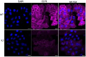 Immunocytochemical staining of HepG2 cells using EGFR antibody (ABIN7798479), 1:1,000), Top panel: wild-type (WT), Bottom panal: EGFR shRNA knockdown (KD). (Recombinant EGFR antibody)