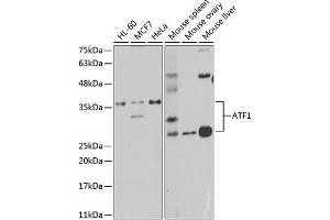 Western blot analysis of extracts of various cell lines, using  antibody (ABIN6127376, ABIN6137228, ABIN6137229 and ABIN6221472) at 1:1000 dilution. (AFT1 antibody  (AA 1-210))