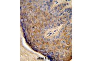 Formalin-fixed and paraffin-embedded human skin tissue reacted with TCHP Antibody (Center), which was peroxidase-conjugated to the secondary antibody, followed by DAB staining. (TCHP antibody  (Middle Region))