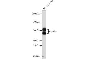 Western blot analysis of extracts of Mouse ovary, using c-Myc antibody (ABIN7268711) at 1:1000 dilution. (c-MYC antibody)