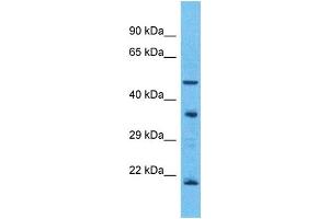 Western Blotting (WB) image for anti-Olfactory Receptor, Family 5, Subfamily T, Member 3 (OR5T3) (C-Term) antibody (ABIN2791781)