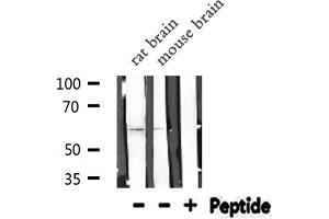 Thrombomodulin antibody  (C-Term)