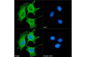 Immunofluorescence staining of fixed NIH3T3 cells with anti-Galectin 9 antibody RG9-35. (Recombinant Galectin 9 antibody)