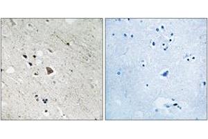 Immunohistochemistry analysis of paraffin-embedded human brain, using FLT3 (Phospho-Tyr969) Antibody. (FLT3 antibody  (pTyr969))