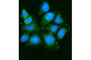 IF analysis of ASK1/MAP3K5 using anti-ASK1/MAP3K5 antibody (ABIN7600304).