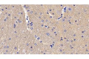Detection of CD90 in Mouse Cerebellum Tissue using Polyclonal Antibody to Cluster of Differentiation 90 (CD90) (CD90 antibody  (AA 20-131))