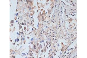 Immunohistochemistry (Paraffin-embedded Sections) (IHC (p)) image for anti-Signal Transducer and Activator of Transcription 1, 91kDa (STAT1) (pSer727) antibody (ABIN7265092)