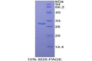 SDS-PAGE analysis of Human MAP3K7IP1 Protein.