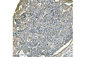 IHC analysis of ATG16L1 using anti-ATG16L1 antibody (ABIN7602244).