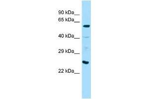Western Blotting (WB) image for anti-Angiopoietin 1 (ANGPT1) (C-Term) antibody (ABIN2789373)