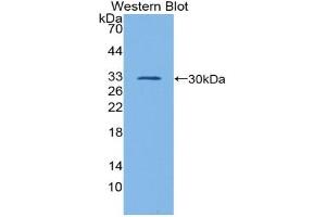 Western blot analysis of the recombinant protein. (GATA1 antibody  (AA 20-265))
