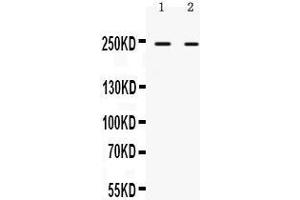 Observed bind size: 242KD (ARID1A antibody  (Middle Region))