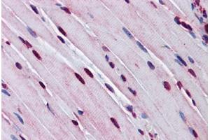 Mouse Skeletal Muscle: Formalin-Fixed, Paraffin-Embedded (FFPE) (TTF1 antibody  (AA 51-100))