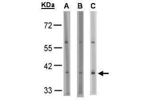 WB Image Sample(30 μg of whole cell lysate) A:HeLa S3 , B:MOLT4, C:Raji , 10% SDS PAGE antibody diluted at 1:1000 (SUCNR1 antibody)