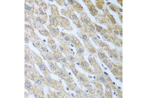 Immunohistochemistry of paraffin-embedded human liver using Eif2ak2 antibody. (EIF2AK2 antibody  (AA 1-270))