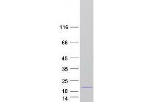 Western Blotting (WB) image for Thioredoxin-Like 4B (TXNL4B) (Transcript Variant 3) protein (Myc-DYKDDDDK Tag) (ABIN2734688)