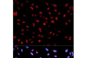 Immunofluorescence analysis of U2OS cells using Phospho-MEF2C(S396) Polyclonal Antibody (MEF2C antibody  (pSer396))