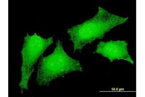 Immunofluorescence of monoclonal antibody to CRKL on HeLa cell. (CrkL antibody  (AA 204-303))