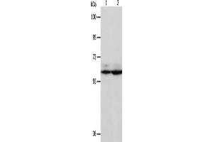 Gel: 8 % SDS-PAGE, Lysate: 40 μg, Lane 1-2: Hela cells, Jurkat cells, Primary antibody: ABIN7130740(PSMD3 Antibody) at dilution 1/300, Secondary antibody: Goat anti rabbit IgG at 1/8000 dilution, Exposure time: 5 seconds (PSMD3 antibody)