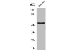 Western Blot analysis of COLO205 cells using NK-3R Polyclonal Antibody (TACR3 antibody  (C-Term))