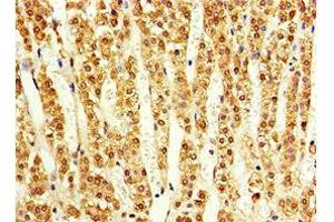 Immunohistochemistry of paraffin-embedded human adrenal gland tissue using ABIN7143179 at dilution of 1:100 (ACVR1C/ALK7 antibody  (AA 22-113))
