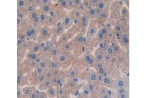 #VALUE! (Complement Factor I antibody  (AA 358-603))