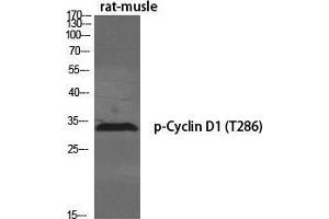 Western Blot (WB) analysis of specific cells using Phospho-Cyclin D1 (T286) Polyclonal Antibody. (Cyclin D1 antibody  (pThr286))