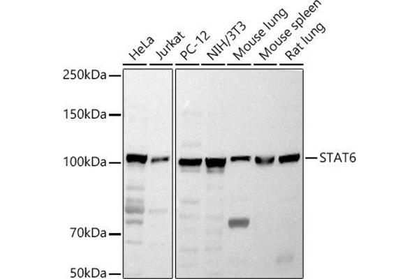 STAT6 antibody  (AA 1-180)