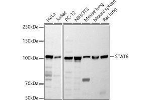 Western blot analysis of extracts of various cell lines, using ST antibody (ABIN6128541, ABIN6148581, ABIN6148582 and ABIN6213980) at 1:1000 dilution. (STAT6 antibody  (AA 1-180))