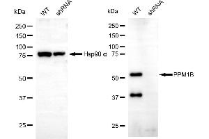Western blotting analysis using PPM1B antibody (ABIN7800033). (PPM1B antibody)