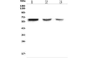 Western blot analysis of RBPJ using anti-RBPJ antibody (ABIN7601670).