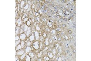 Immunohistochemistry of paraffin-embedded human esophagus using UBE2A antibody (ABIN6132760, ABIN6149782, ABIN6149784 and ABIN6223686) (40x lens). (UBE2A antibody  (AA 1-152))