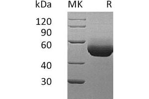 Western Blotting (WB) image for Interleukin 5 Receptor, alpha (IL5RA) (Active) protein (His tag) (ABIN7320600) (IL5RA Protein (His tag))