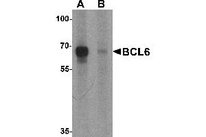 Western blot analysis of BCL6 in rat lung tissue lysate with Bcl6 antibody at 1 µg/mL in (A) the absence and (B) the presence of blocking peptide (BCL6 antibody  (Middle Region))
