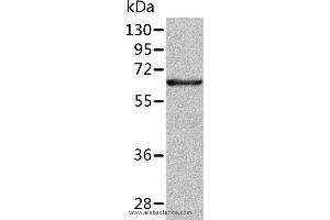 Western blot analysis of Human fetal liver tissue, using ALDH4A1 Polyclonal Antibody at dilution of 1:350 (ALDH4A1 antibody)