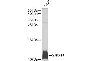 Western blot analysis of extracts of H460 cells, using STR antibody (ABIN6133039, ABIN6148631, ABIN6148632 and ABIN6225238) at 1:1000 dilution. (STRA13 antibody  (AA 1-63))