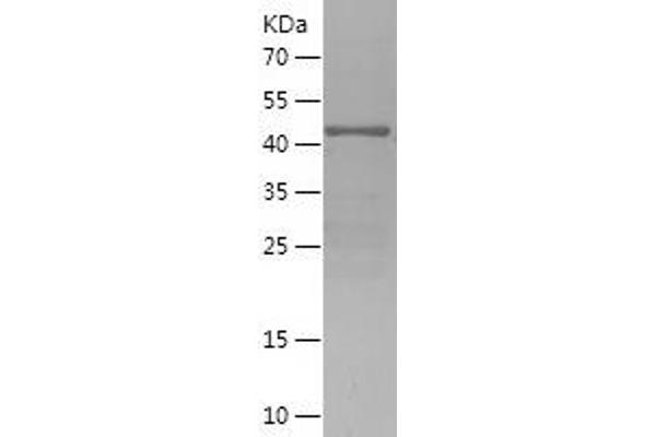 DACH1 Protein (AA 552-758) (His-IF2DI Tag)