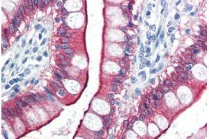 Human Small Intestine (formalin-fixed, paraffin-embedded) stained with VIL1 antibody ABIN337303 at 10 ug/ml followed by biotinylated anti-mouse IgG secondary antibody ABIN481714, alkaline phosphatase-streptavidin and chromogen. (VILL antibody)