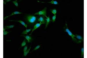 Immunofluorescence staining of Hela cells with ABIN7167302 at 1:185, counter-stained with DAPI. (RAB35 antibody  (AA 1-201))