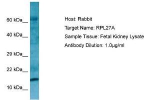 Western Blotting (WB) image for anti-Ribosomal Protein L27a (RPL27A) (C-Term) antibody (ABIN2790162)