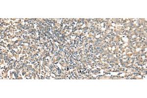 Immunohistochemistry of paraffin-embedded Human tonsil tissue using CD1D Polyclonal Antibody at dilution of 1:25(x200) (CD1d antibody)