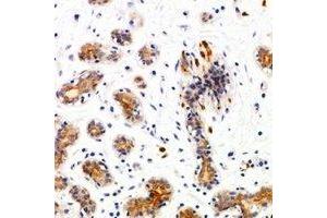 Immunohistochemical analysis of SEC22B staining in human breast formalin fixed paraffin embedded tissue section.