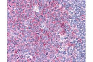 Immunohistochemistry (IHC) image for anti-Heat Shock Protein 90kDa alpha (Cytosolic), Class A Member 1 (HSP90AA1) (N-Term) antibody (ABIN2779296) (HSP90AA1 antibody  (N-Term))