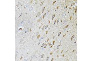 Immunohistochemistry of paraffin-embedded rat brain using ND5 antibody (ABIN5975833) at dilution of 1/100 (40x lens). (MT-ND5 antibody)