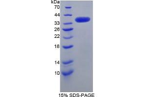 Image no. 1 for serine/arginine-Rich Protein Specific Kinase 3 (SRPK3) (AA 247-517) protein (His tag) (ABIN4991074)