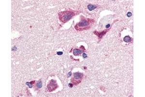 Immunohistochemistry of TRAIL in human brain tissue with this product at 20 μg/ml. (TRAIL antibody  (C-Term))